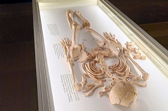 Vinseum inaugurarà divendres una exposició on mostrarà diverses restes de la necròpolis medieval de Cal Pa i Figues